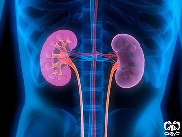 بیماری های خاص که عملکرد کلیه‌ها را مختل می‌کند